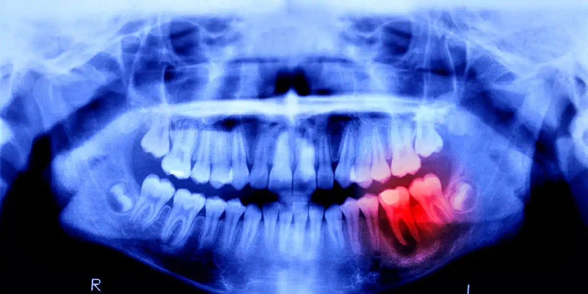 Humans May Be Able to Grow New Teeth Within Just 6 Years