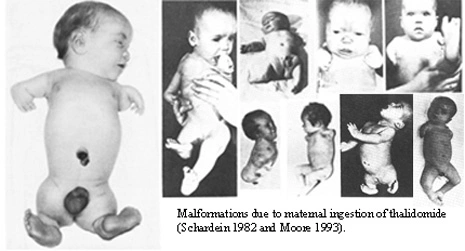 Thalidomide scandal - Wikipedia