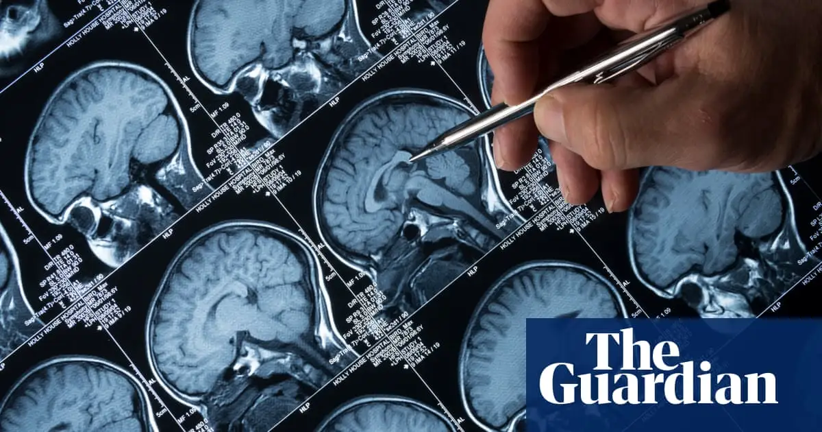 Poor physical health associated with depression through link to brain, research shows