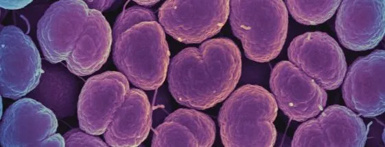 Gonorrhea is becoming unstoppable; highly resistant cases found in US